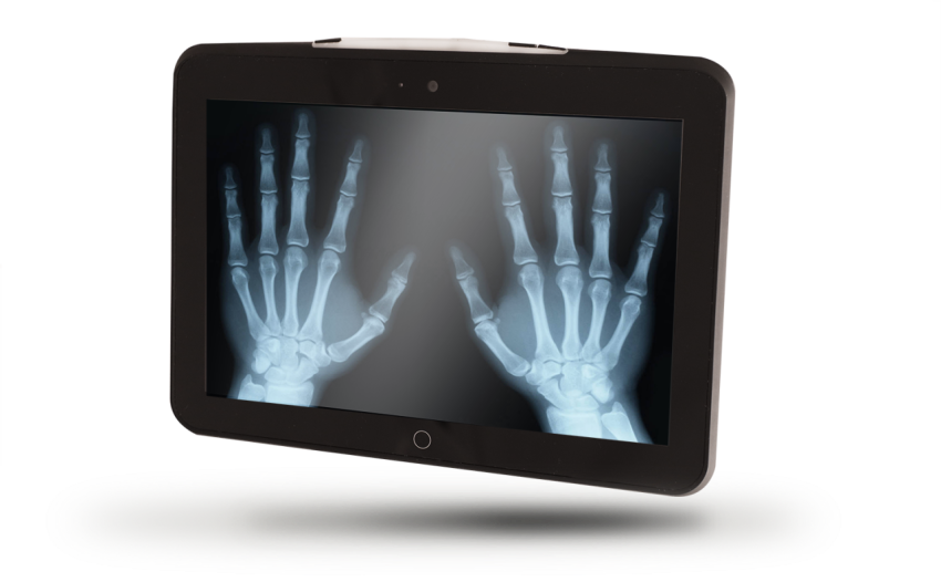 X Ray On Hands Image PNG Screen Image
