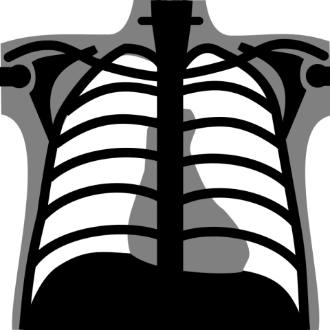 Chest X Ray PNG Clipart Image
