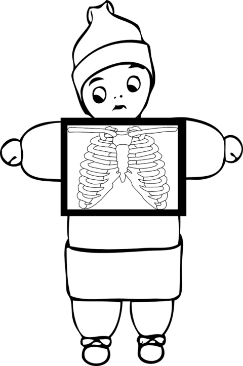 X Ray PNG Image With Transparent Background