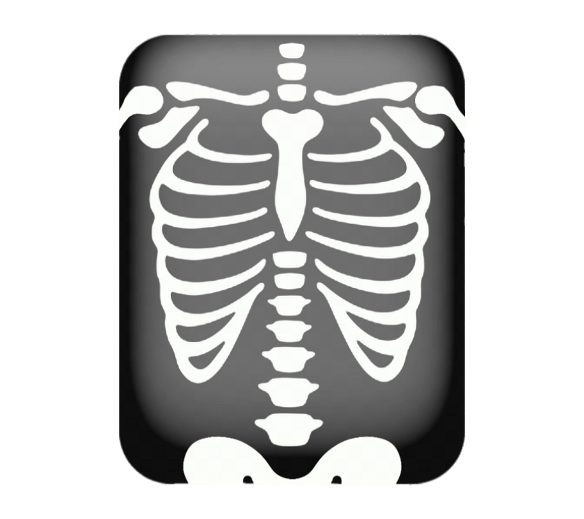 X Ray PNG Picture Download Free