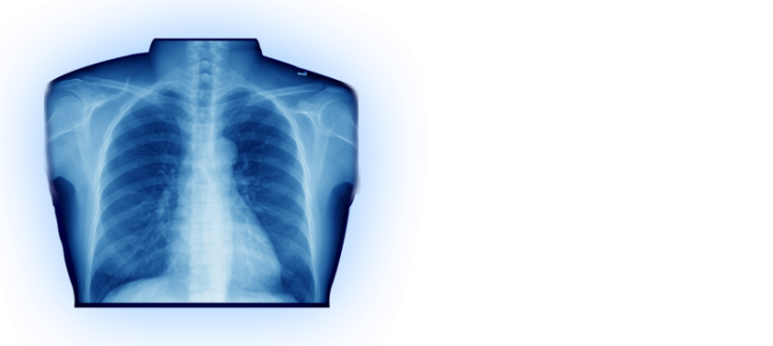Free Health Care X Ray PNG Icon Download Free