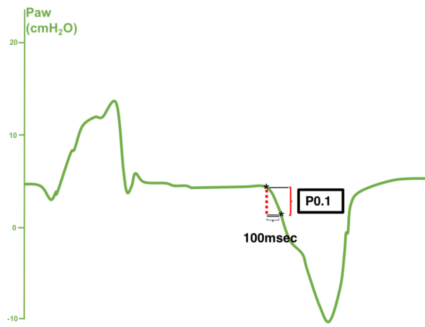 ICU Mechanical Ventilator PNG Graph On Transparent Background